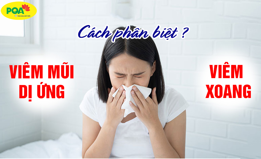 Tìm hiểu bệnh viêm mũi dị ứng và viêm xoang [Cách đẩy lùi bệnh từ gốc]