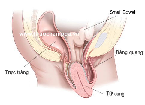 Top 15+ câu hỏi hay nhất về bệnh sa tử cung bạn cần biết